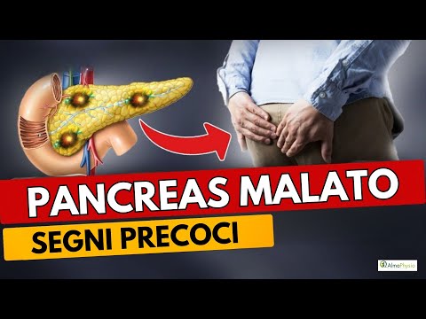 PANCREATIC CANCER: EARLY SIGNS OF A SERIOUS PROBLEM