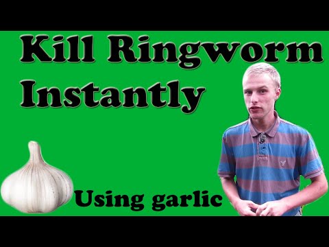 Kill Ringworm Instantly (Using Garlic)