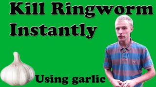 Kill Ringworm Instantly (Using Garlic)
