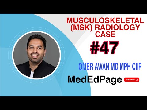 Musculoskeletal (MSK) Radiology CASE  #47