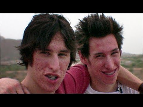 Watch lagu Images Videos Famous Plastic Surgery Twins, Watch Images Famous Plastic Surgery Twins free Watch, Watch Images Famous Plastic Surgery Twins
