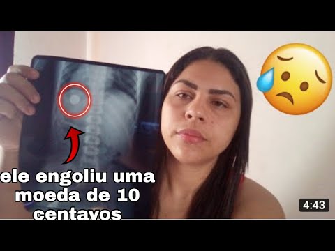 My 7-year-old son swallowed a coin / explaining everything that happened with Daniel...