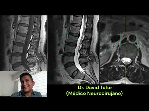 David Tafur Muñoz-3537