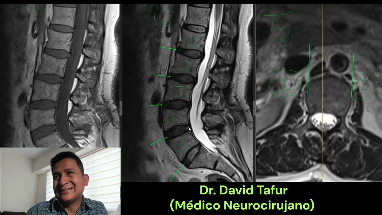 David Tafur Muñoz-2471