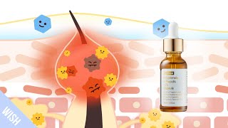 How does Wishtrend Polyphenols in Propolis 15% Ampoule Improve Acne-prone Skin type