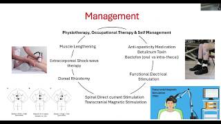 UK HSP Support Group 2025: Spasticity in HSP, Causes, Impact and Mangement