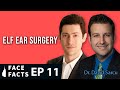 Elf Ear / Spock Ear Surgery - Dr. Gary Linkov