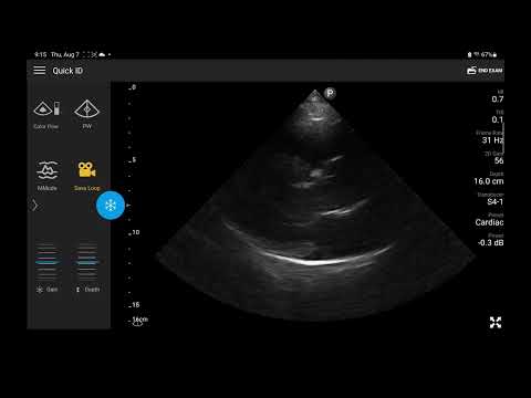 Lumify Models Names