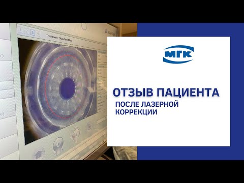 Видео Лазерная коррекция зрения