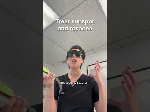 BBL treatment for skin rejuvenation⚡ #facialtreatment #bbl #medispa #montreal #lasertreatment