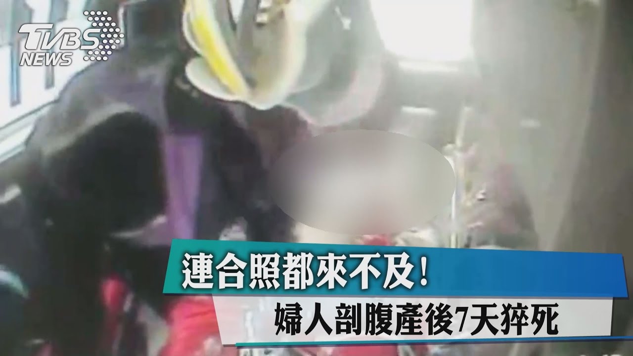連合照都來不及!婦人剖腹產後7天猝死