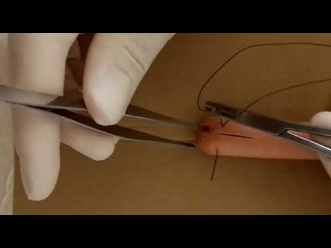 Running a couple of blair-donati points