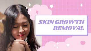 Remove Skin Growths :: Subliminal to Get Rid of Unwanted Lumps and Bumps