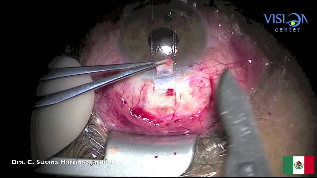 C. Susana Martinez Jardon-23