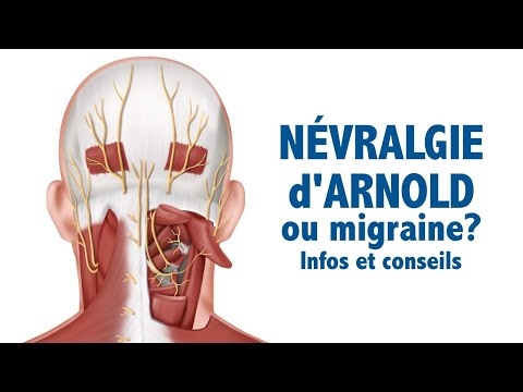 Névralgie d'Arnold ou migraine? Infos et conseils