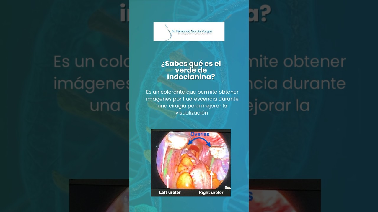 Fernando Garcia Vargas-10