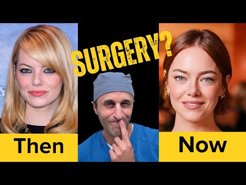 Emma Selling Sunset Plastic Surgery