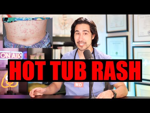 HOT TUB RASH!  Doctor Explains #hottubrash #skin #skincare