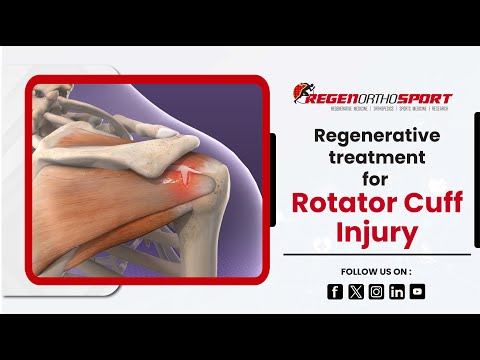 Minimally-Invasive Procedures to Treat Rotator Cuff Injuries | RegenOrthoSport
