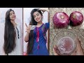 How To Use Onion Juice For Extreme Hairfall Hair Loss Dandruff Shanu Priya