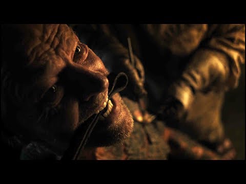 Game of Thrones S7E2 - Sam treats Jorah Mormont