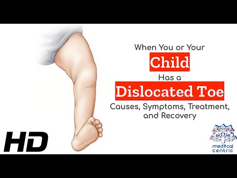 Hydrocephalus Causes Signs and Symptoms Diagnosis and Treatment