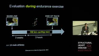 Maladaptation of the Right Ventricle in Athletes – Dr Guido Claessen