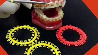 จัดฟันเริ่มต้น​ 30000​ผ่อน​เดือนละ​ 1500​ จัดฟัน​โดย​ทันตแพทย์​เฉพาะ​ทาง