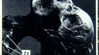 The Mystery Of The Cocaine Mummy.avi