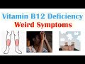 Vitamin B12 Deficiency Weird Symptoms Why They Occur