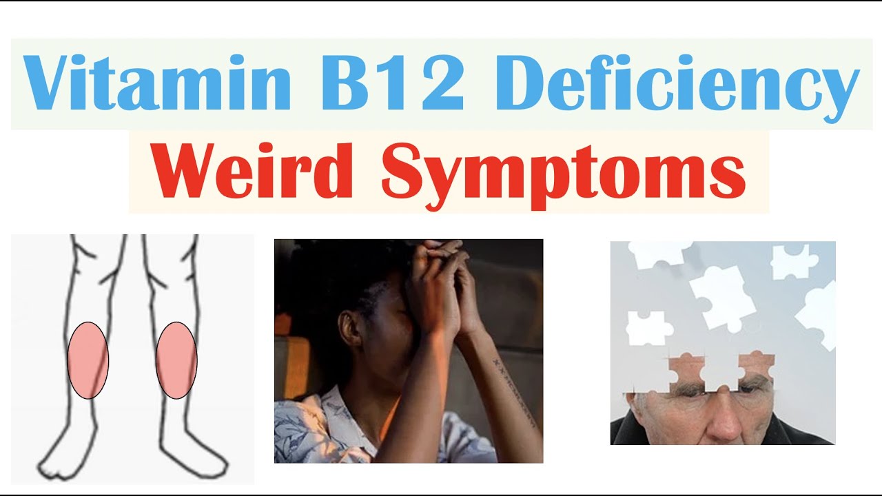 What are the classic symptoms of B12 deficiency? Tipseri