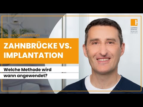 Zahnbrücke oder Implantat - was ist besser? Vor- und Nachteile