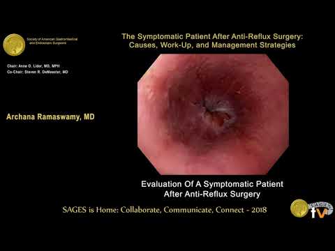 Evaluation after failed anti-reflux surgery from the SAGES Video Library