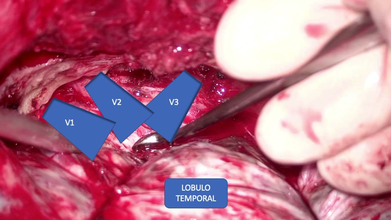 Victor Hernandez Alvarez-1