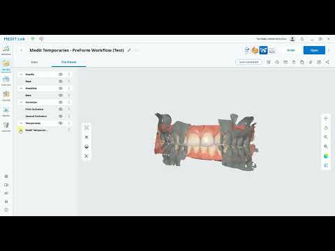 Medit: Medit Temporaries - PreForm Workflow