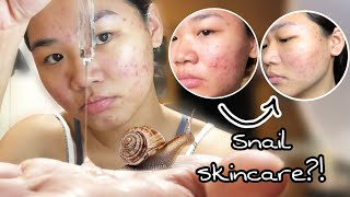 Download lagu Some By Mi Snail Truecica Review (2 weeks) mp3