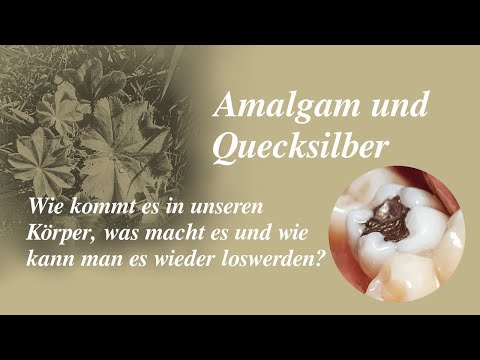 Amalgam- & Quecksilberausleitung