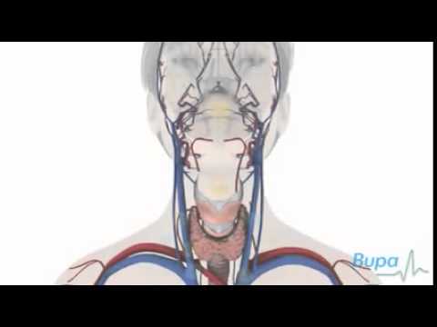 Jet berang-berang mempengaruhi potensi Merangsang audiobook wanita