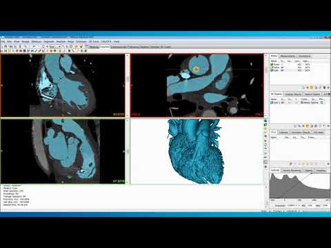 Jak stworzyć model serca do drukowania 3D