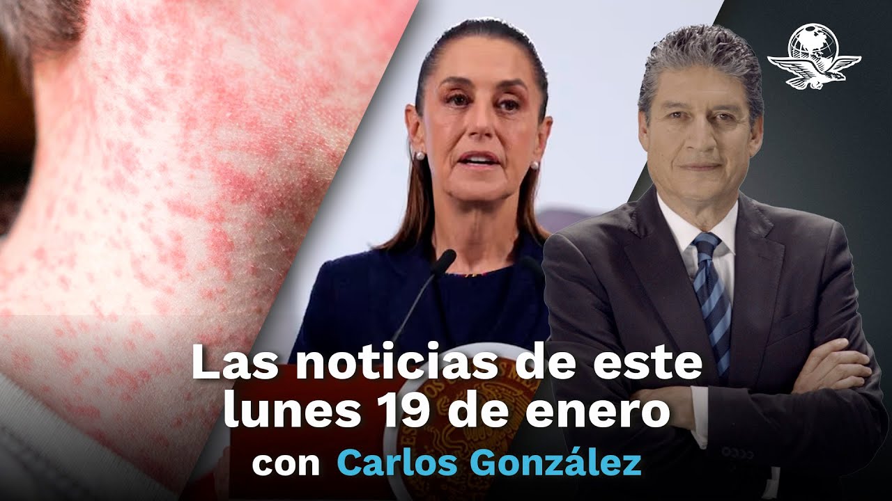 Brote de sarampión en México alcanza los 7 mil 131 casos