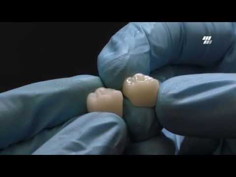 BRILLIANT Crios and DIATECH ShapeGuard: a perfect team for restaurations!