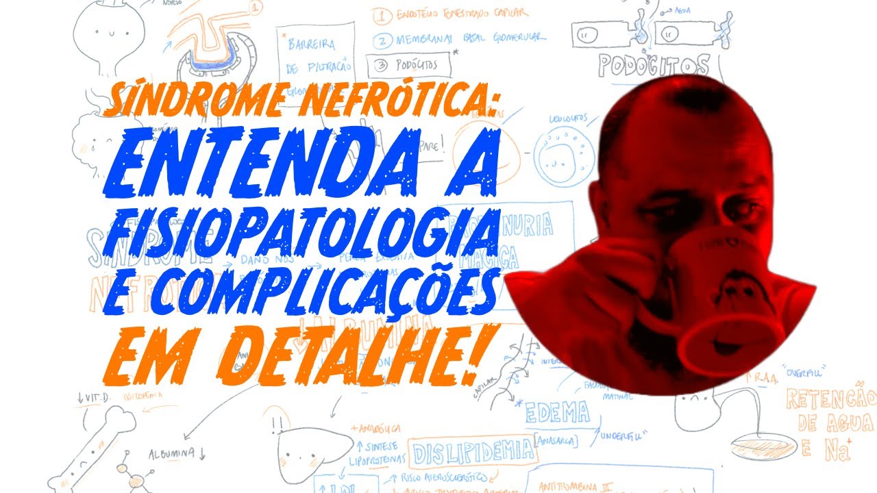 Síndrome Nefrótica: Entenda a Fisiopatologia e Complicações em Detalhe!