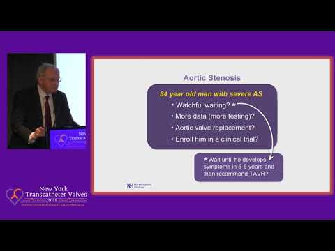 Natural History of Aortic Stenosis - a 50 Year Journey - Dr. Robert Bonow