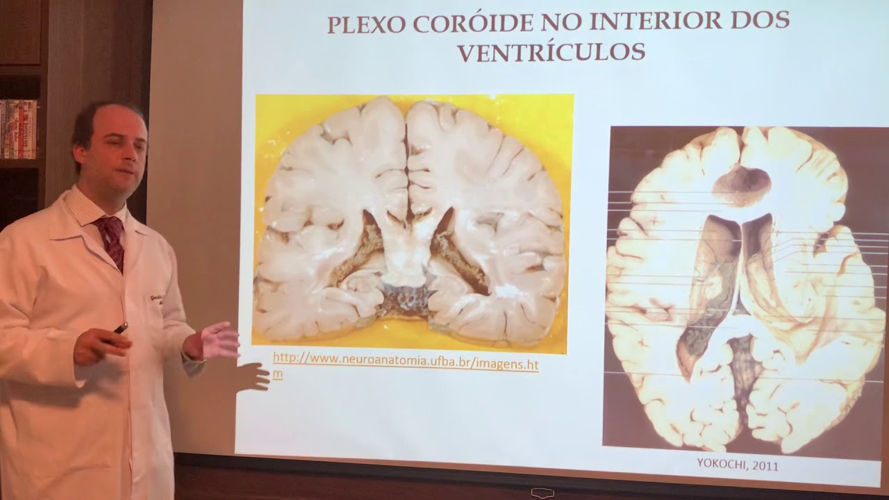 Neuroanatomia - Líquor e Circulação Liquórica