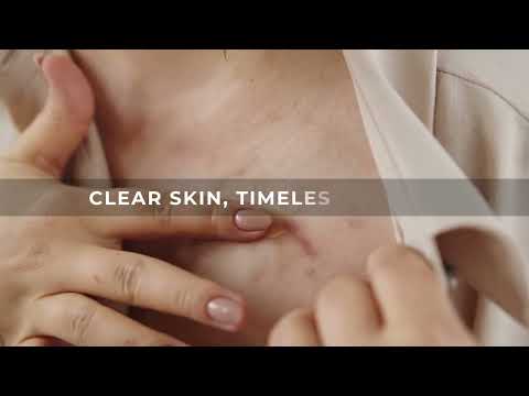 Beauty Skin Cream for Dry Skin (100 gm)