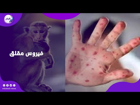 جدري القرود و نهاية العالم .. ليلي عبد اللطيف تتوقع وباء عالمي!