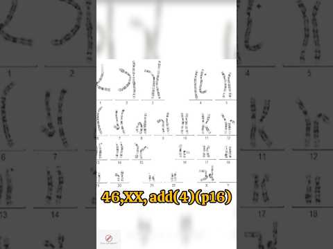 Abnormal Karyotype Part 11 🧬❌️ #biology #genetics #shorts