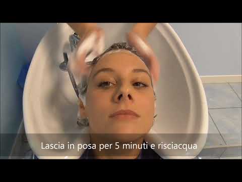 Creme per disposizione di lentiggini Su che la pigmentazione di pelle parla