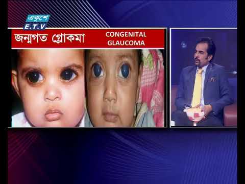 চোখের চাপ জনিত গ্লোকমা রোগ ( দ্যা ডক্টর’স) ১৭ মার্চ ২০১৮