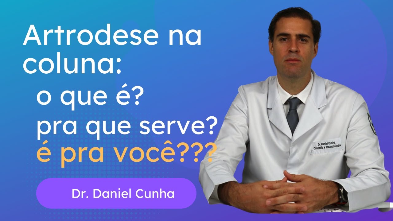Artrodese na Coluna vertebral -  O que é ? pre que serve e para quem ela é indicada ?